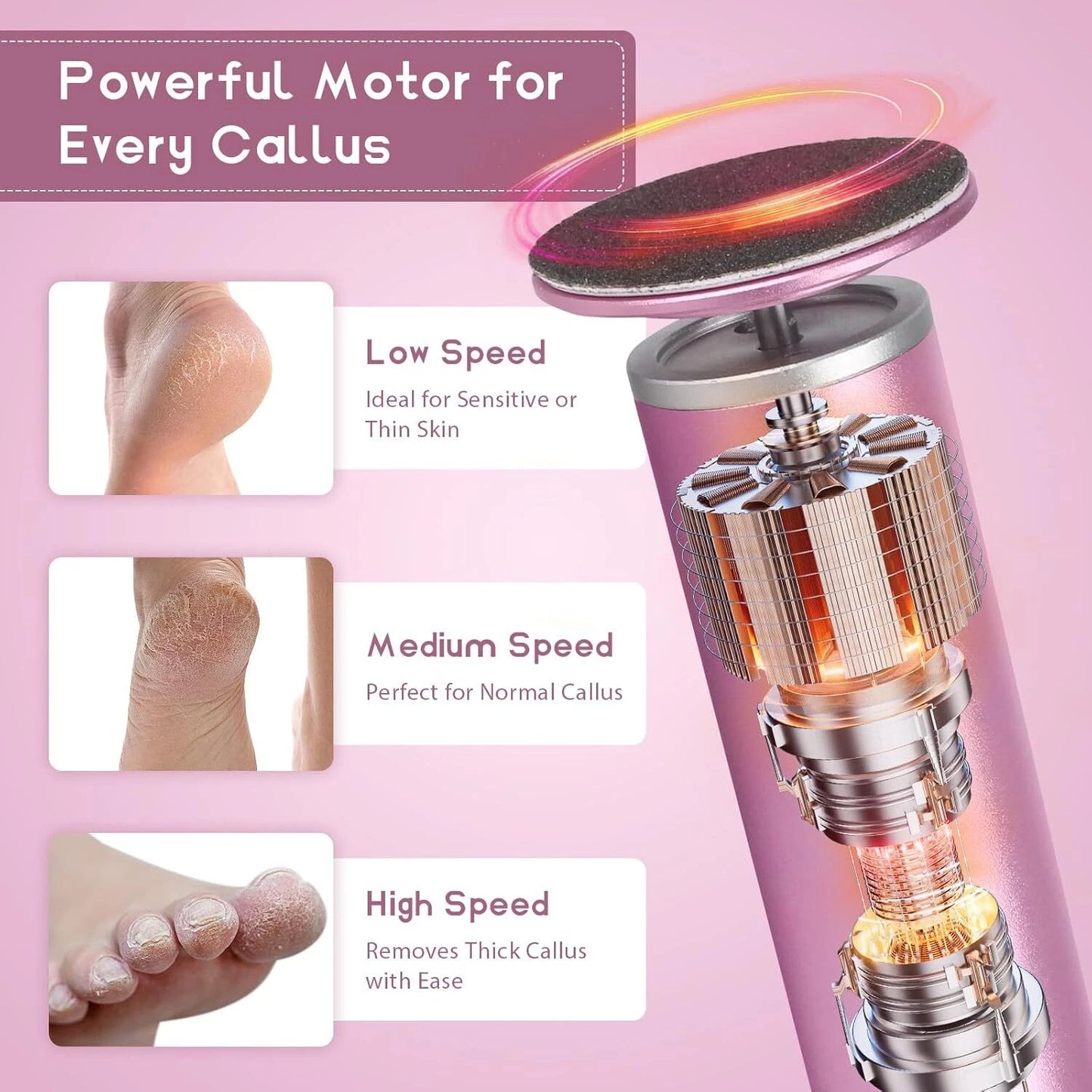 SmoothStep Callus Remover