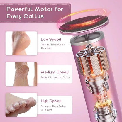 SmoothStep Callus Remover